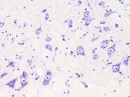 Procedimiento de tinción de las células nerviosas