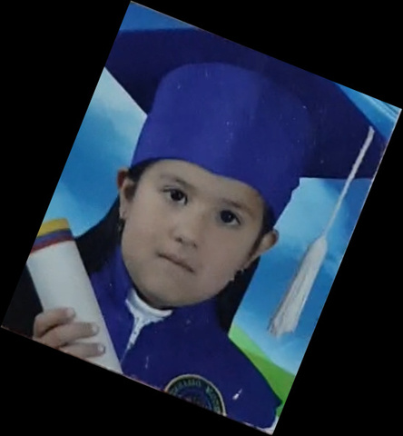 Transitional graduation