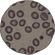 Leeuwenhoek, Malpighi y Swammerdan, describen las células sanguíneas.