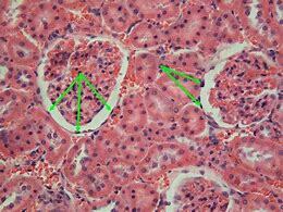 the nucleus in epithelial cells