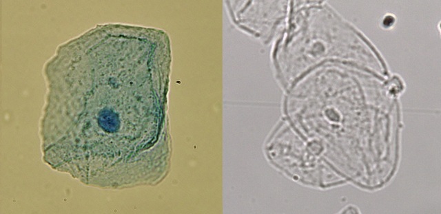 Rudolf Virchow, “Cellulapathologie”.