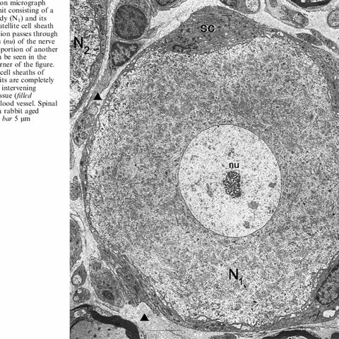 Nerve Cell Body