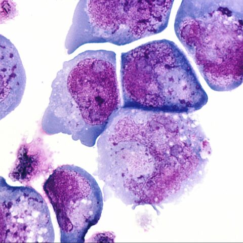 M Ferrés, HANTAVIRUS (FONDECYT N°1161447).