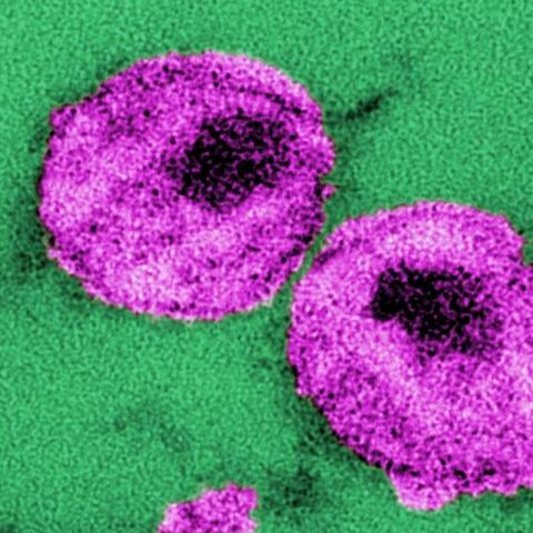 M Ferrés, HANTAVIRUS (FONDECYT N°1161197).