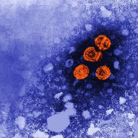 M Ferrés y M López-Lastra, HANTAVIRUS (Proyecto Anillo PIA ACT 1408).