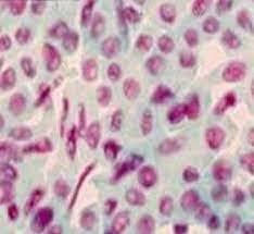 Método de tinción del ADN.