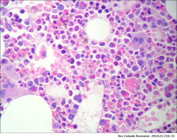 G. Tejon / M. Bono, proyecto 3160224.