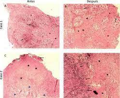V. Palma, Proyecto D09I1047