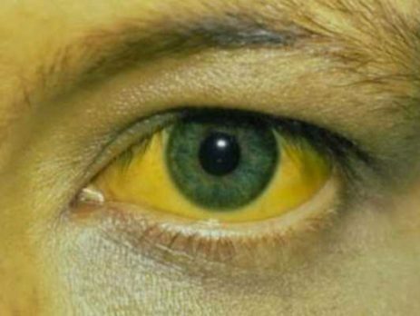 Sawver Kitchen y Lloyds