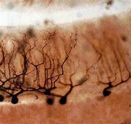 Golgi discovers the black reaction