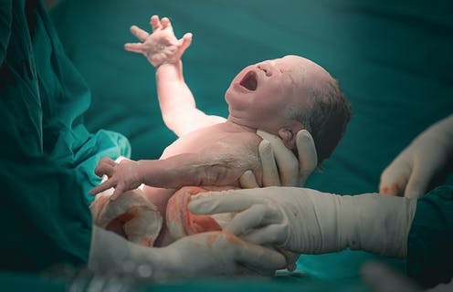 Birth