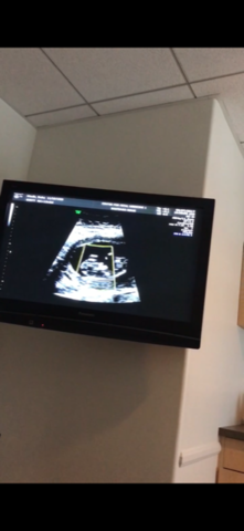 I found out I'm having a new brother