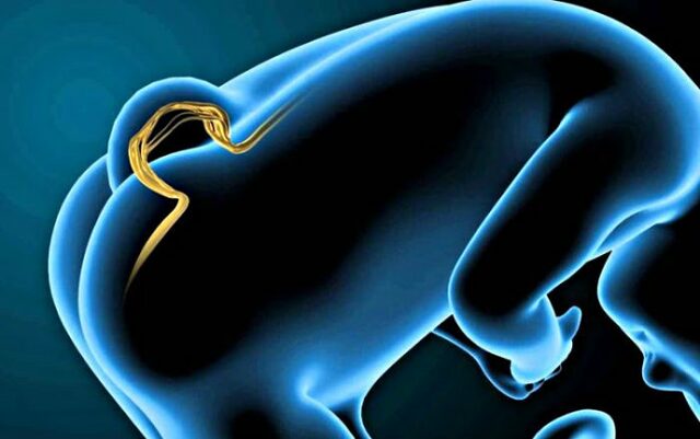 Placa neural (dia 19)