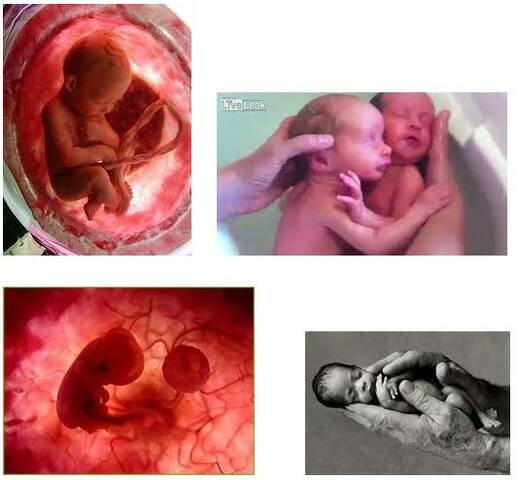 Orígenes del desarrollo de la salud y enfermedad