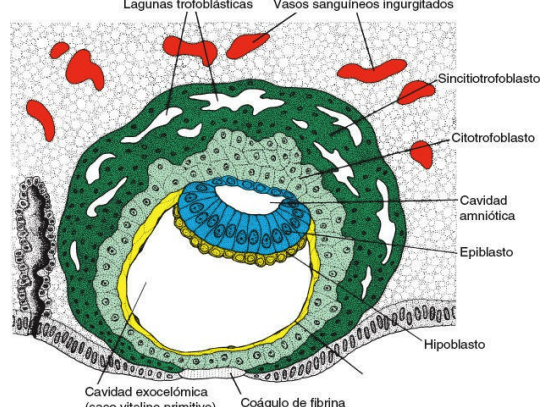Trofoblasto con laguna