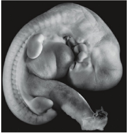 Embrión en la quinta semana, longitud cefalocaudal 5-8mm