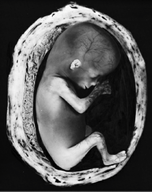 Feto de 12 semanas dentro del útero