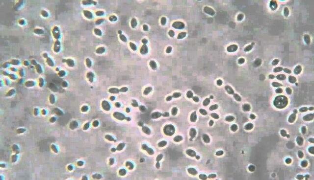 Movimiento browniano