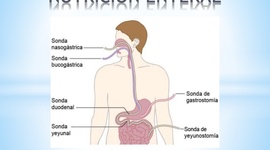 Timeline: Nutrición Enteral
