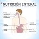 Nutricin enteral heee11 1 638
