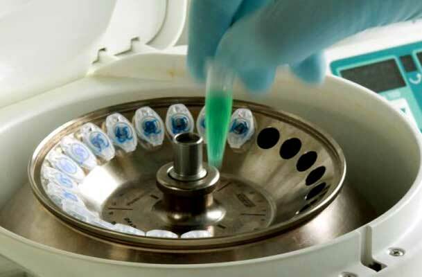 Ultra en- trifuga(1923)