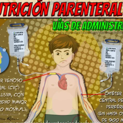 Timeline: Nutrición parenteral