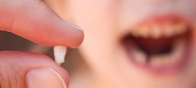 Les primeres dents que s'em van caure.