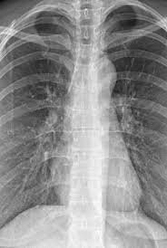 Röntgenové vyšetrenie