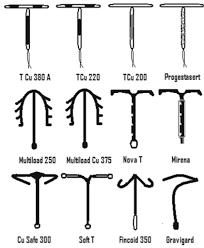 DISPOSITIVOS INTRAUTERINOS