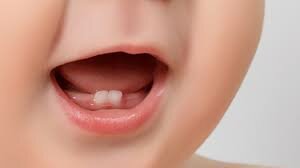 Em creix la primera dent