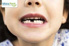 S'em cau la meva primera dent