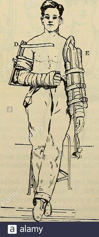 LA FÉRULA DE THOMAS