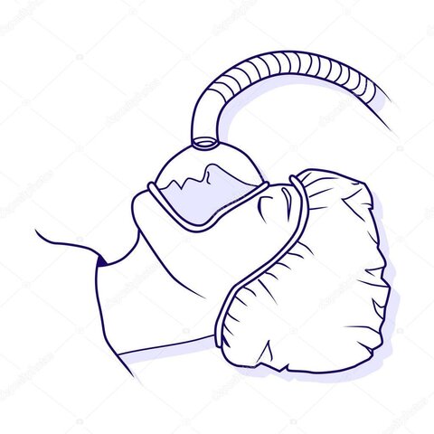 Creación de la anestesia