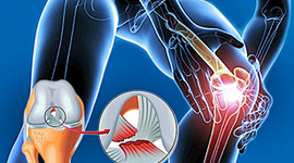 Timeline: Act.4 Lesiones ligamentosas