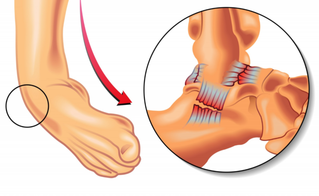 Ligamento