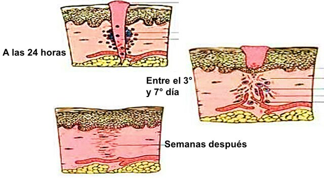 Fase de remodelación