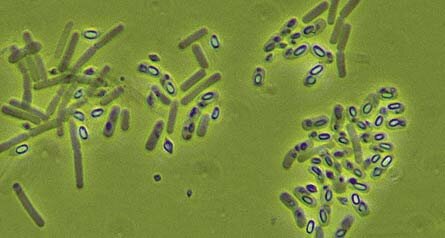 Chantemasse y Vidal prueban nuevamente la vacuna de Beumer y Peiper pero con Bacilos muertos.