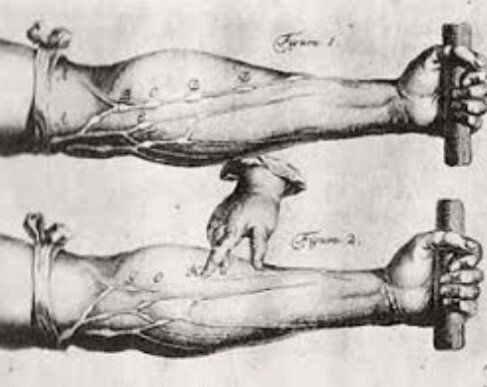 Inyección Intravenosa