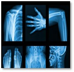 Descubrimiento de los Rayos X