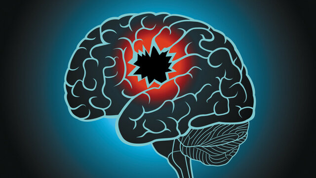 Conrad, lesiones en lo hemisferios cerebrales