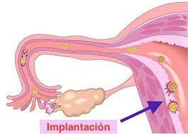 IMPLANTACIÓ