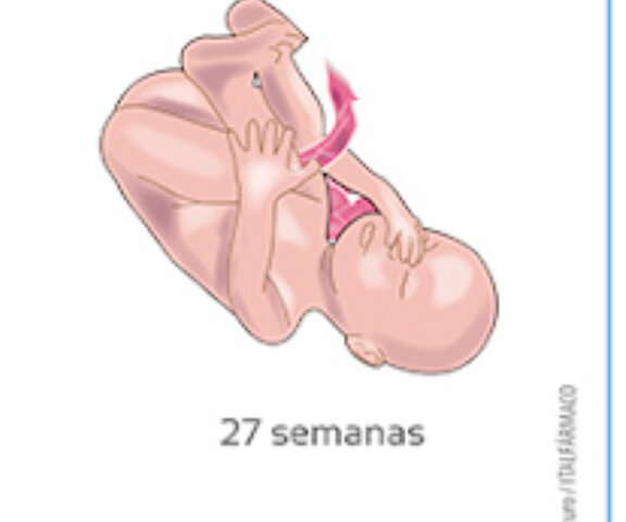 SOBREVIURE A UN PART