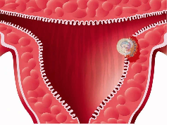 (Dia 6) Implantació