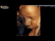 (Setmana 37) Funcions integratives