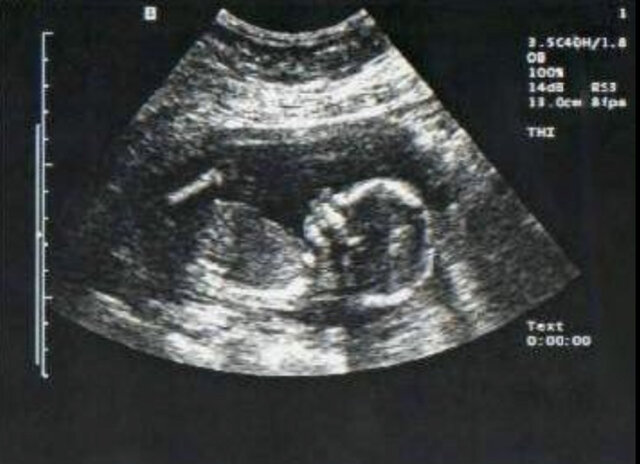 Primeres respostes (22 setmanes)