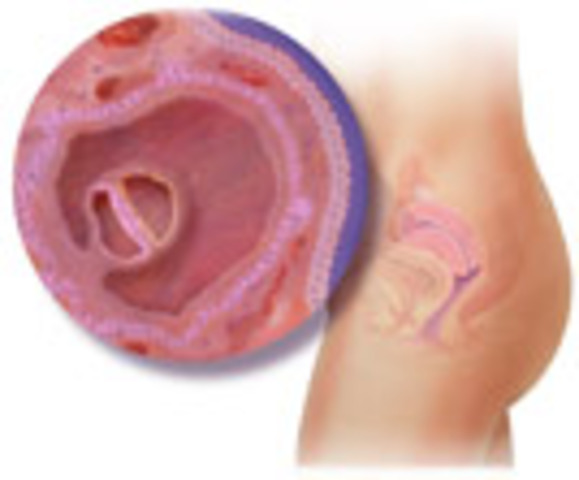 prenatal (frist month)