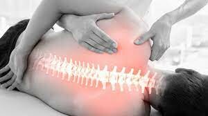 QUIROPRACTICA O QUIROPRAXIA (medicina alternativa)