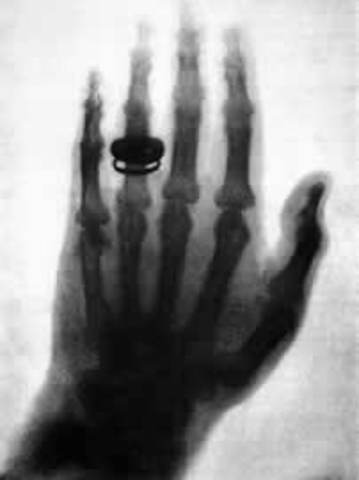 X-Ray