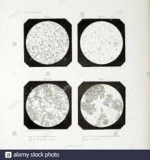 1845 Alfred Donné y Léon Foucault