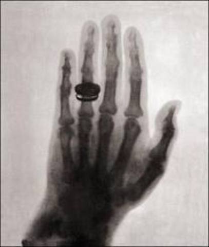 1895 x-rays